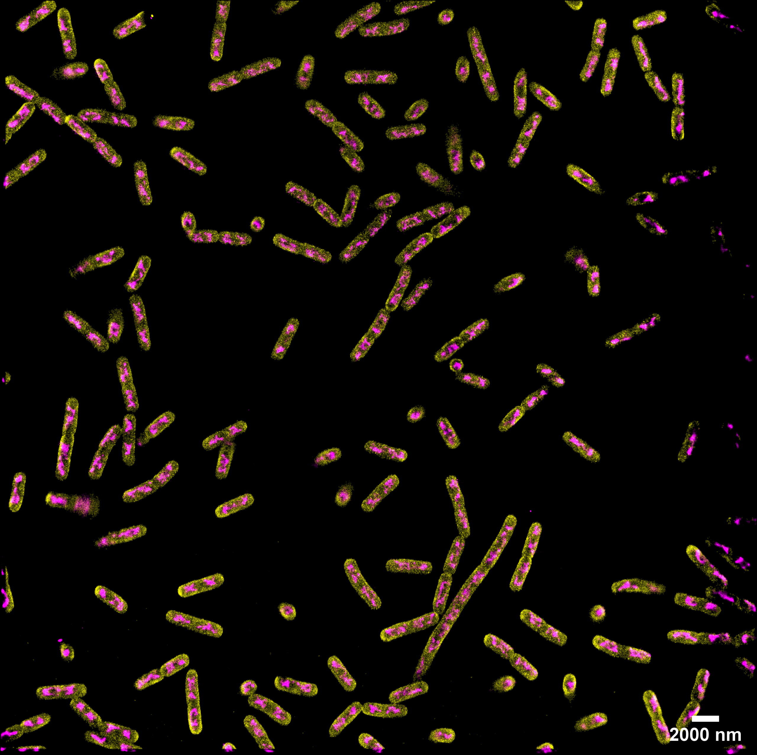 E. coli  Membrane and Chromosome
