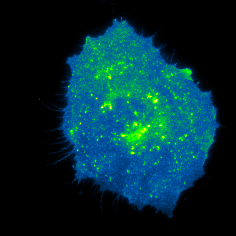 Pushing the Boundaries of TIRF Excitation for Various Sample Media ...